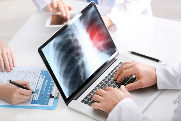 Лікар працює з ноутбуком за столом у лікарні. Рентгенівське зображення грудей на екрані. Концепція раку легенів — стокове фото
