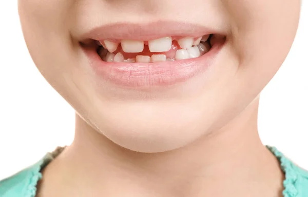 Nettes lächelndes Mädchen auf weißem Hintergrund, Nahaufnahme. Mundhygienekonzept — Stockfoto