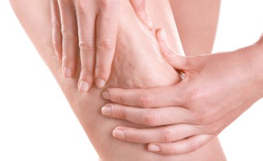 Beyaz arka plan üzerinde selülit sorunu olan kadın