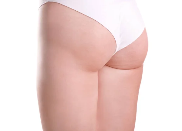 Donna con problema di cellulite su sfondo bianco — Foto Stock