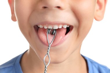 Logopedic sonda konuşma düzeltme beyaz arka planda, portre sevimli çocukla