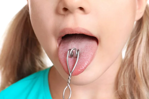 Menina com sonda logopédica para correção de fala — Fotografia de Stock