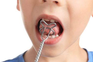 Logopedic sonda konuşma düzeltme beyaz arka planda, portre sevimli çocukla