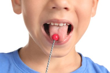 Logopedic sonda konuşma düzeltme beyaz arka planda, portre sevimli çocukla