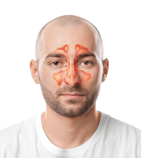 Man met illustratie van de neusbijholten sinus op witte achtergrond. Astma concept — Stockfoto
