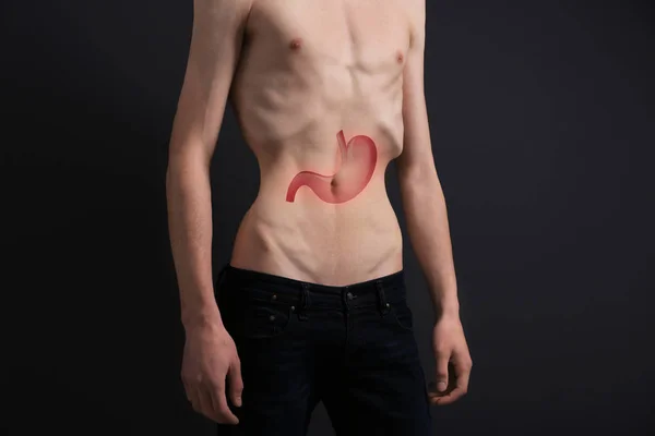 Jeune homme maigre avec illustration de l'estomac sur fond sombre. Concept de cancer — Photo