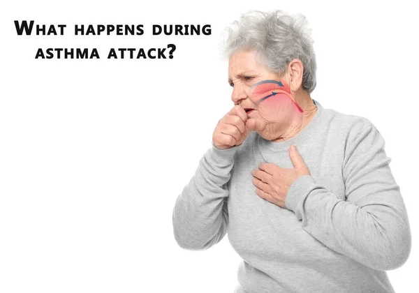 Starší Žena Ukázkou Krku Text Stane Při Astmatický Záchvat Bílém — Stock fotografie