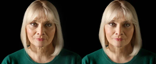 Mature woman before and after biorevitalization procedure on black background — Stock Photo, Image