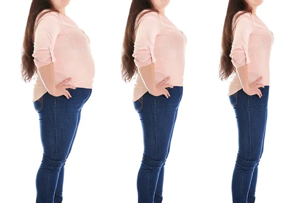 Γυναίκα πριν και μετά την απώλεια βάρους — Φωτογραφία Αρχείου