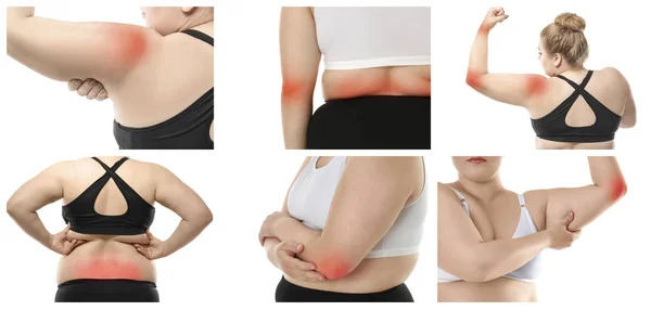 Kolaż z nadwagę kobieta cierpi na ból w różnych częściach ciała na białym tle — Zdjęcie stockowe