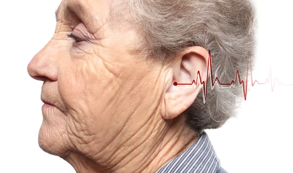 Ανώτερος Γυναίκα Σύμπτωμα Της Απώλειας Ακοής Λευκό Φόντο — Φωτογραφία Αρχείου