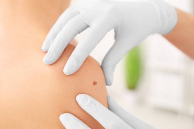 Onkoloji kliniğinde muayene hasta. Kanseri Bilinçlendirme
