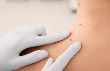 Onkoloji kliniğinde muayene hasta. Kanseri Bilinçlendirme