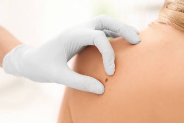Onkoloji kliniğinde muayene Bayan hasta. Kanseri Bilinçlendirme