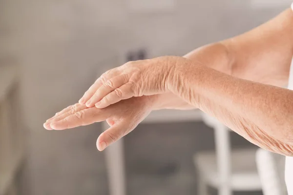 Hände Der Seniorin Mit Gesunder Durch Creme Mit Feuchtigkeitsspendender Wirkung — Stockfoto