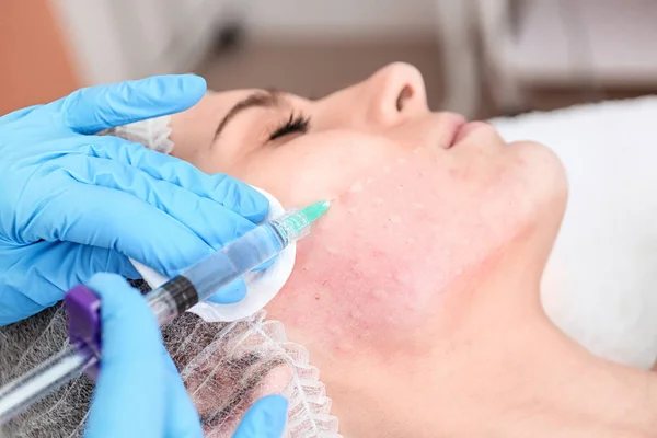美容師は、女性の顔にクローズ アップ注入を行います。Biorevitalization 手順 — ストック写真