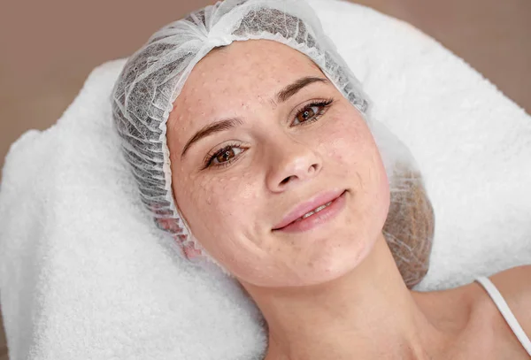 Young woman after biorevitalization procedure in salon — Stock Photo, Image