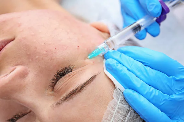 Esteticista a fazer injecção no rosto da mulher, close-up. Procedimento de biorvitalização — Fotografia de Stock