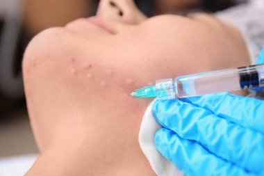 Kadının yüzüne, closeup enjeksiyon yapma güzellik uzmanı. Biorevitalization yordamı
