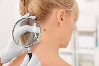 Onkoloji kliniğinde büyüteç ile muayene Bayan hasta. Kanseri Bilinçlendirme