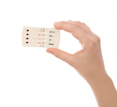 HIV, hepatit B, C ve frengi için test beyaz arka planda tutan kadın