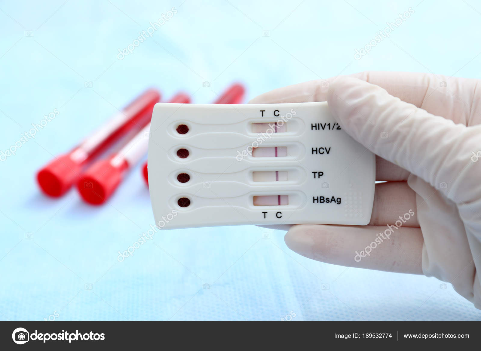 Экспресс тест на вич гепатит сифилис. Тест на вич и гепатит. Исследование на вич. Тест на вич и гепатит. Экспресс тест полоска на гепатит с.
