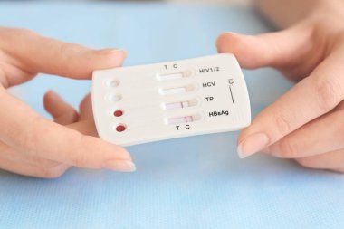 HIV için kadın holding test