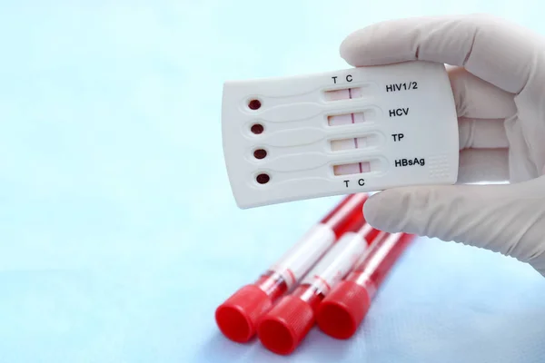 Arzt hält Test für Hiv — Stockfoto