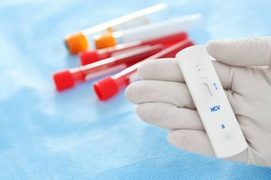 Hızlı test Hcv için tutan doktor