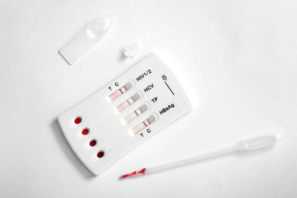 Kit di test per HIV, epatite B, C e sifilide — Foto Stock