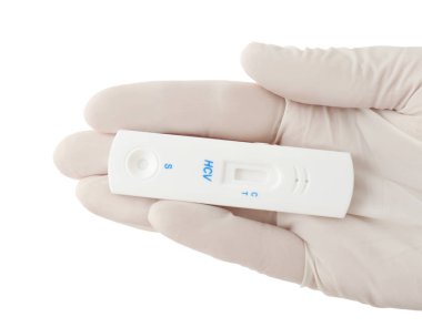 Hızlı test Hcv için beyaz arka planda tutan doktor