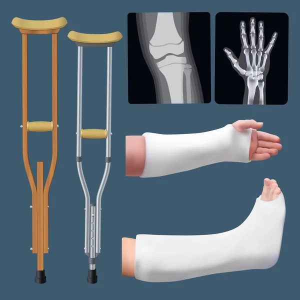 医学救急オブジェクトのセット。骨折の治療。しっくいのスプリント、松葉杖、x 線。孤立したオブジェクト。ベクトル — ストックベクタ