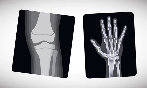 Röntgen der Hand und des Fußes. Vektor — Stockvektor