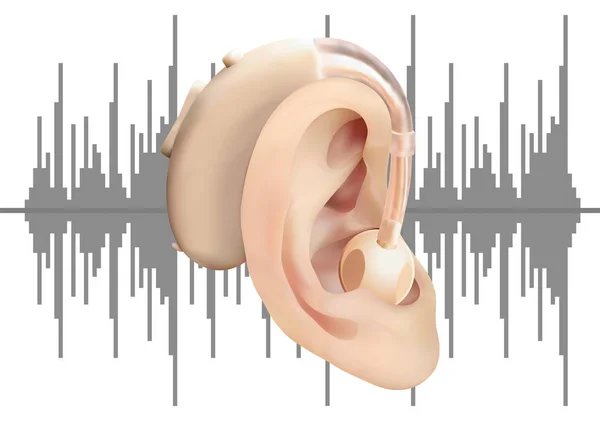 Audífono digital detrás de la oreja, en el fondo del diagrama de onda sonora. Tratamiento y prótesis de la pérdida auditiva en otorrinolaringología. Ilustración vectorial realista. Medicina y salud . — Vector de stock