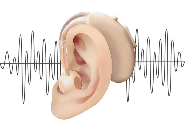 Цифровой слуховой аппарат за ухом, на фоне диаграммы звуковых волн. Лечение и протезирование потери слуха в отоларингологии. Реалистичная векторная иллюстрация. Медицина и здоровье . — стоковый вектор