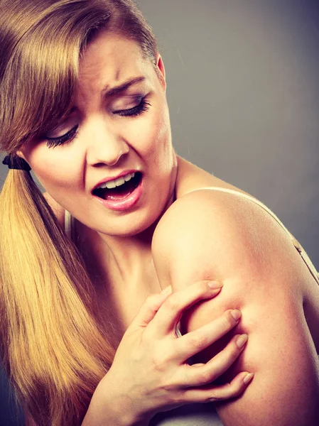 Mujer rascarse el brazo picante con erupción alérgica — Foto de Stock