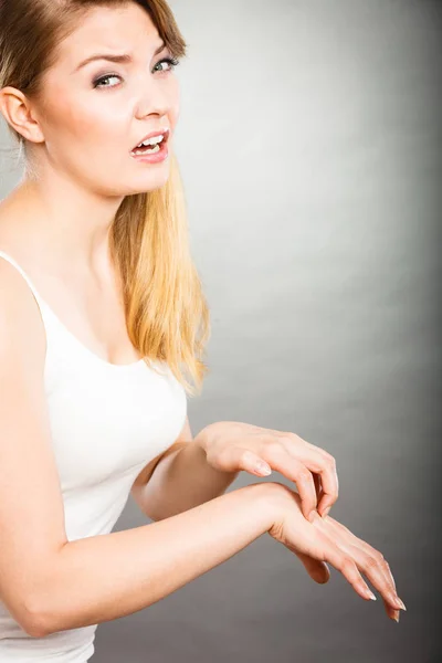 Weibchen kratzt ihre juckende Handfläche mit allergischem Ausschlag — Stockfoto