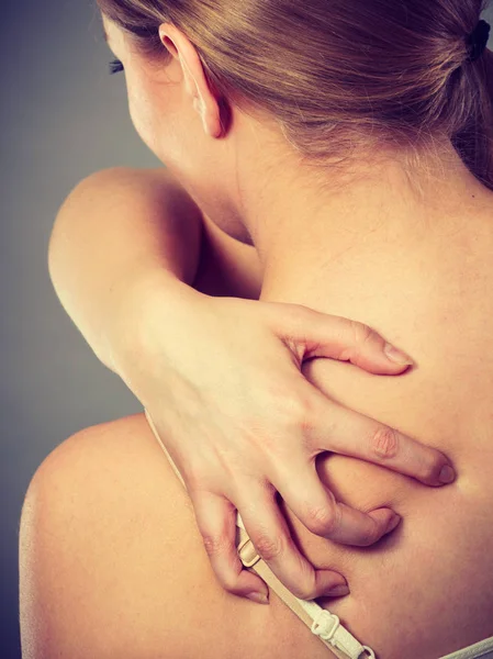 Vrouw haar jeukende terug met allergie huiduitslag krabben — Stockfoto