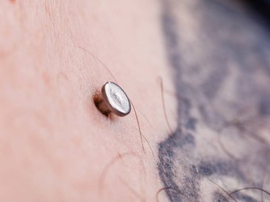 Göğüs kemiği, bölünme, microdermal, köprücük üzerinde piercing yüzey.