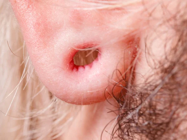 Gestrekte man oor na tunnel piercing — Stockfoto