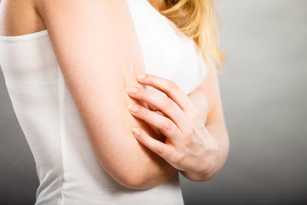 Vrouw haar jeukende arm met allergie huiduitslag krabben — Stockfoto