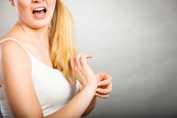 Femme qui se gratte le poignet avec une éruption allergique — Photo