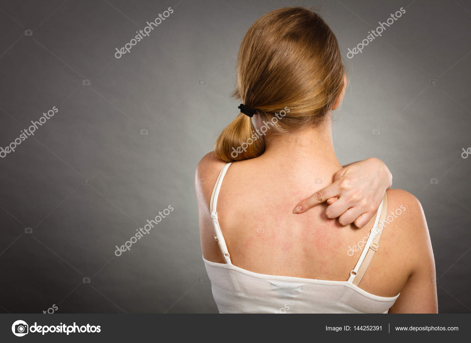 Woman scratching her itchy back with allergy rash Stock Photo by ©Anetlanda  157086218