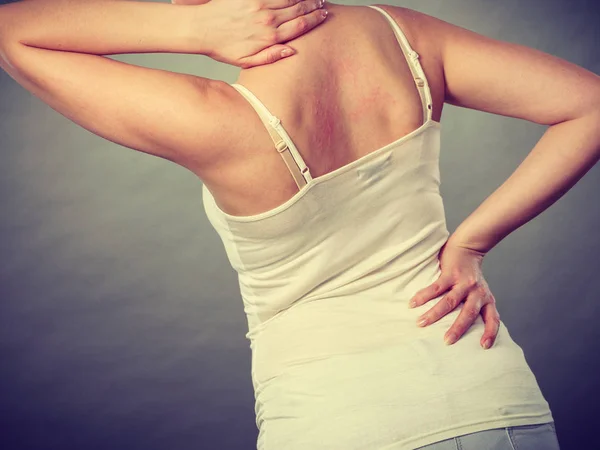 Frau kratzt sich mit allergischem Ausschlag am juckenden Rücken — Stockfoto