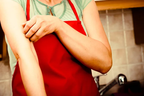 Mujer arañando el brazo con comezón. Alergia . — Foto de Stock