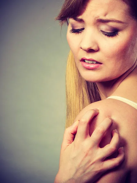 Mujer rascarse el brazo picante con erupción alérgica — Foto de Stock