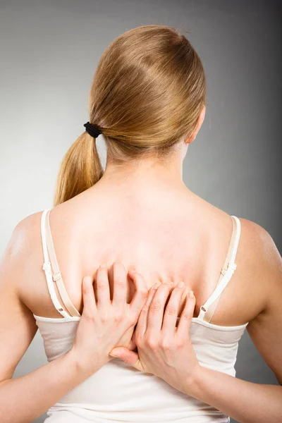 Vrouw haar jeukende terug met allergie huiduitslag krabben — Stockfoto