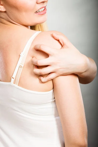 Žena, škrábání zádech svědění s alergií vyrážka — Stock fotografie