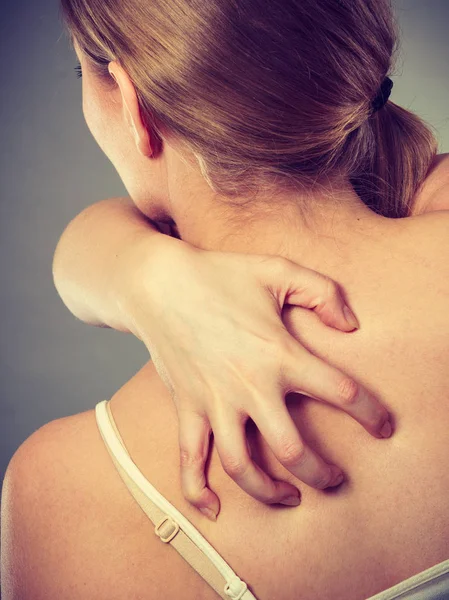 Woman scratching her itchy back with allergy rash — Stock Photo, Image