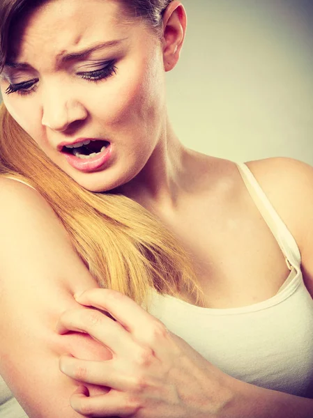 Жінка подряпає її сверблячу руку алергічним висипом — стокове фото